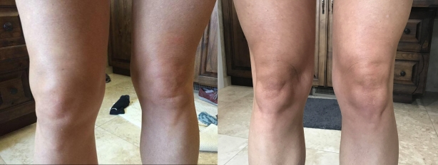 Avis client FlexiSoin - Sophie K.