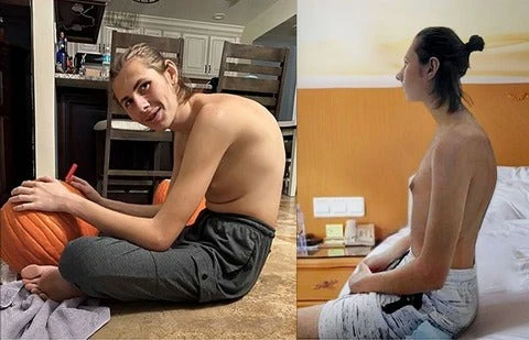 Avant / après FlexiSoin – posture